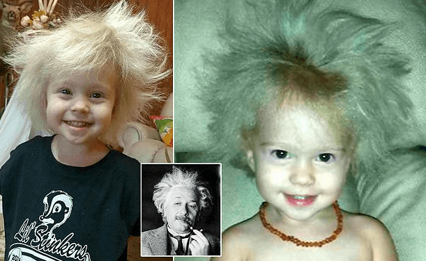 Dyvjeçarja me flokët e çuditshme si Albert Einstein!