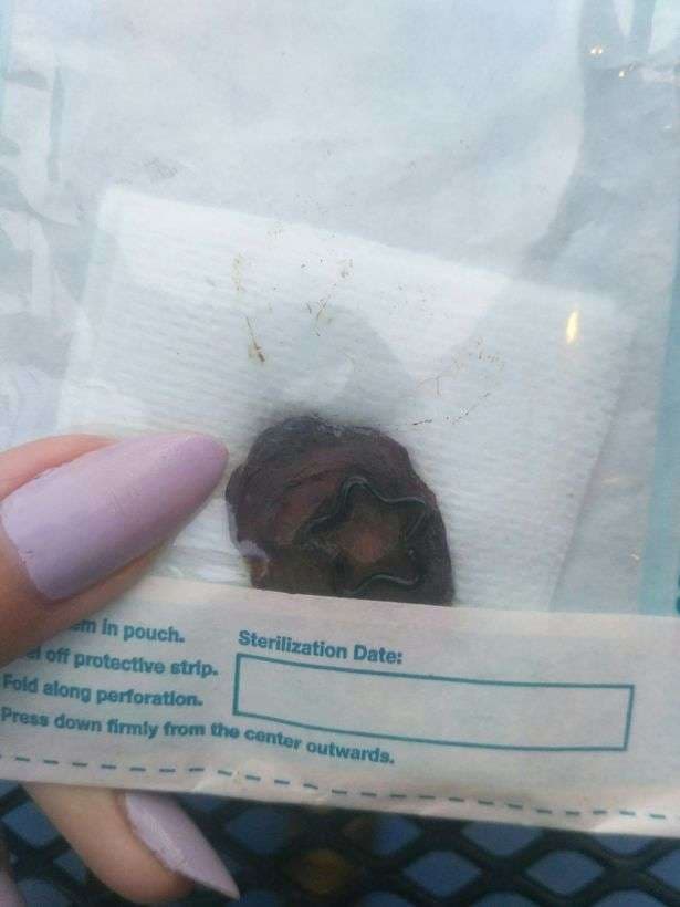 Ndodh edhe kjo! Heq kërthizën dhe ia dhuron të dashurit (FOTO)