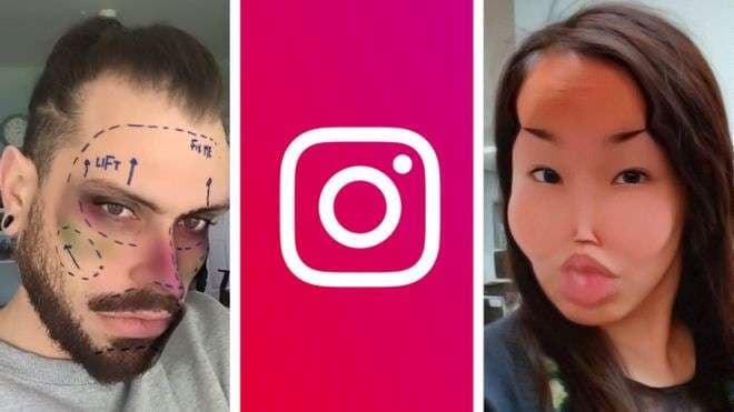 Instagram heq filtrat që promovojnë kirurgjinë kozmetike, dëmtojnë shëndetin mendor