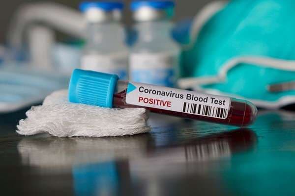Rastet globale me COVID-19 shënojnë rritje rekorde, 400 mijë raste të reja në 24 orë