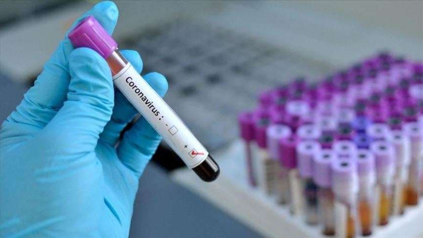 Maqedoni: Dy viktima dhe 41 të infektuar me Covid-19 gjatë 24 orëve të fundit