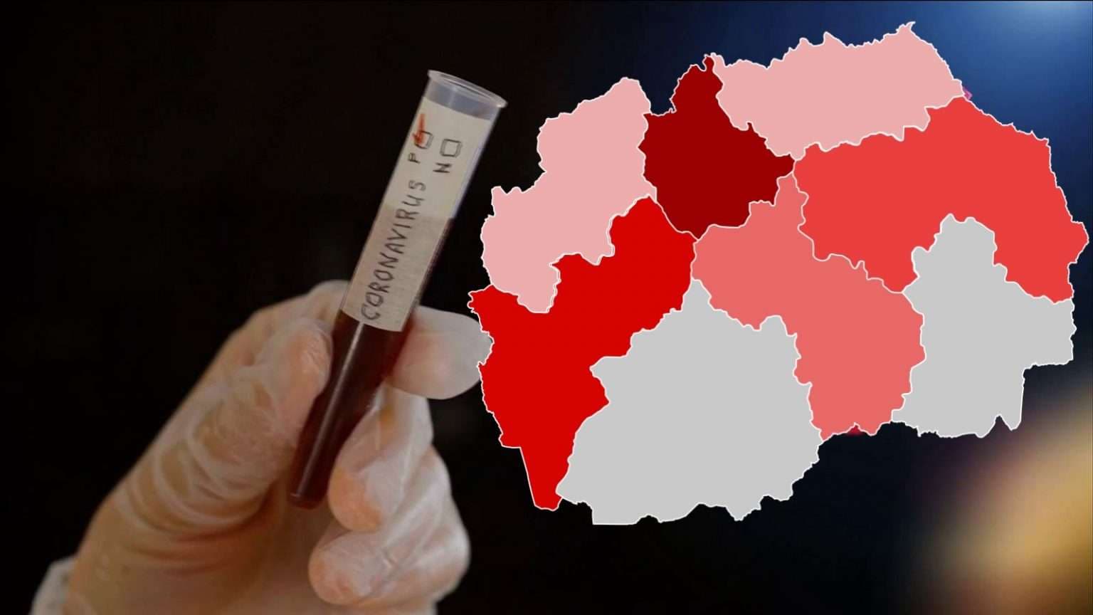 Edhe 41 të prekur me koronavirus në Maqedoninë e Veriut