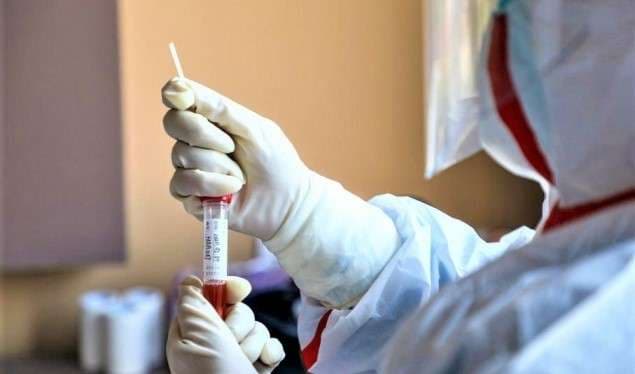 Në zonat e banuara me serbë regjistrohen 52 raste të reja me COVID-19