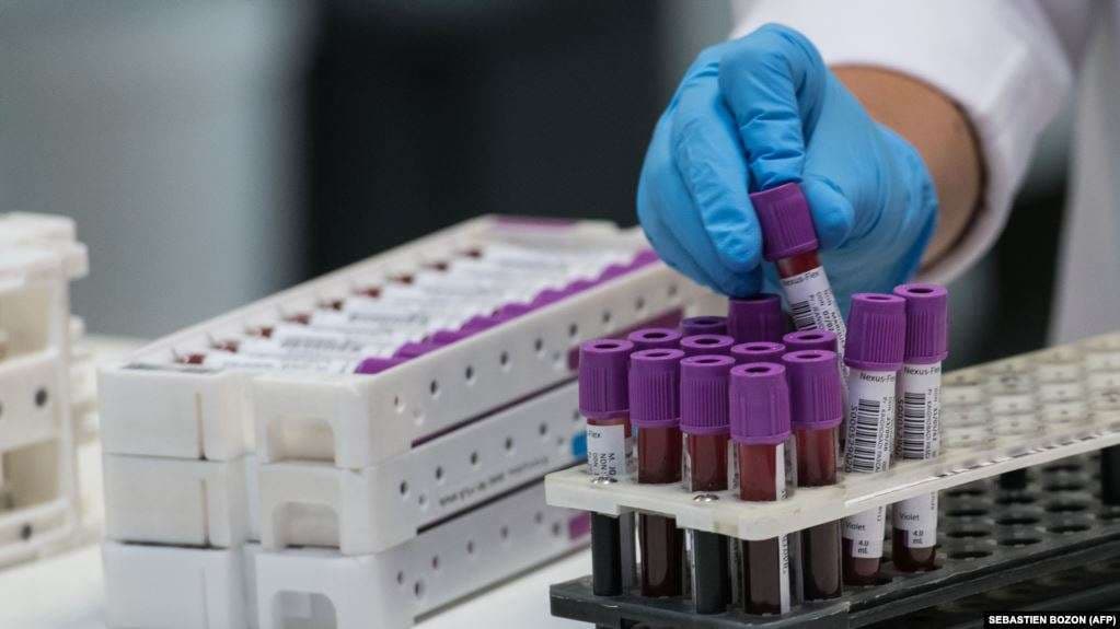 Licensohen edhe 12 laboratorë privat për testime serologjike SARS COV-2