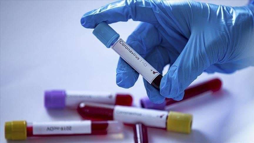 Maqedoni e Veriut: Gjashtë të vdekur dhe 137 raste të reja me koronavirus