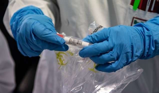 Edhe 59 raste të reja me koronavirus në Mal të Zi