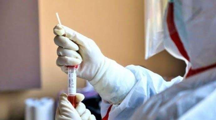 Maqedoni e Veriut: 145 raste të reja me COVID-19, dy viktima
