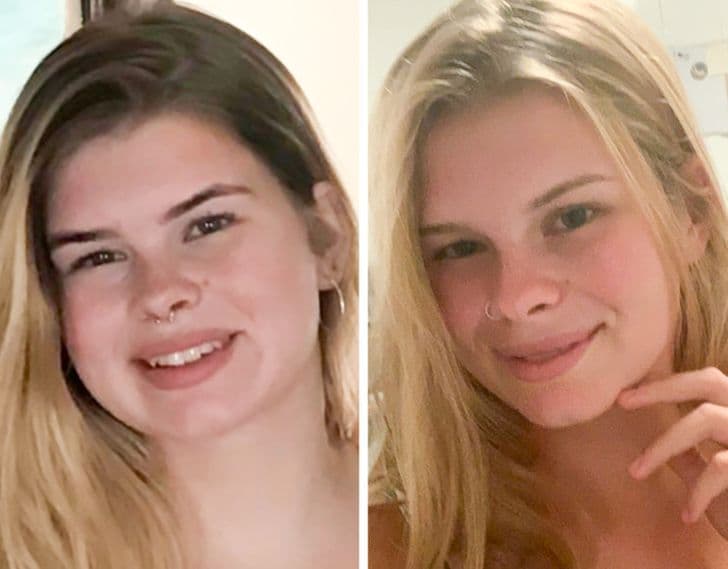 20 fotografi që tregojnë se si humbja e peshës mund ta ndryshojë fytyrën tuaj