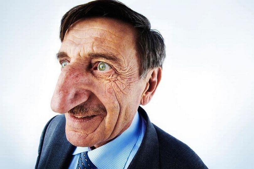 Ky është 71 vjeçari me hundën më të madhe në botë