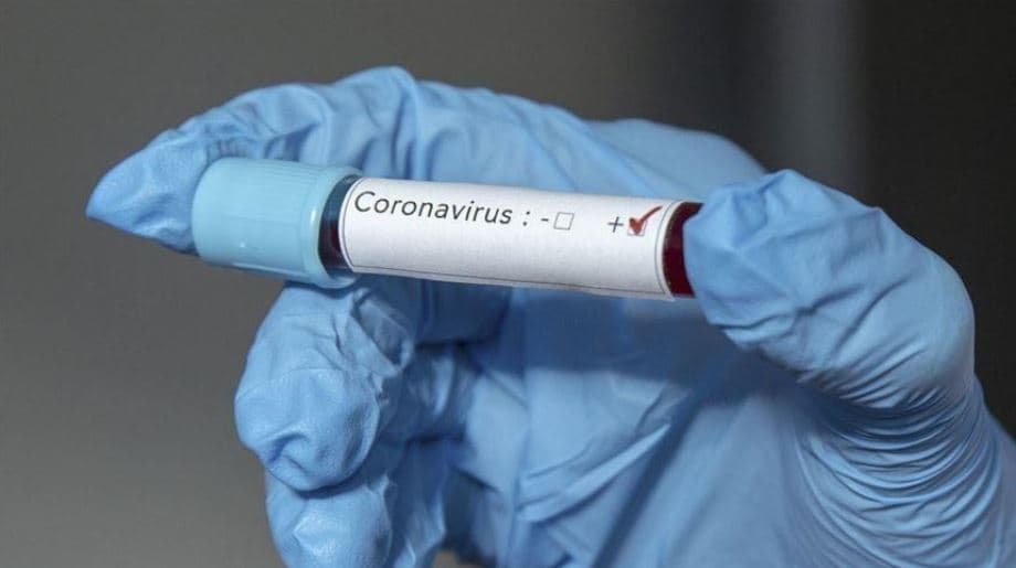 Një i vdekur dhe 25 raste pozitive me koronavirus në 24 orë në Kosovë
