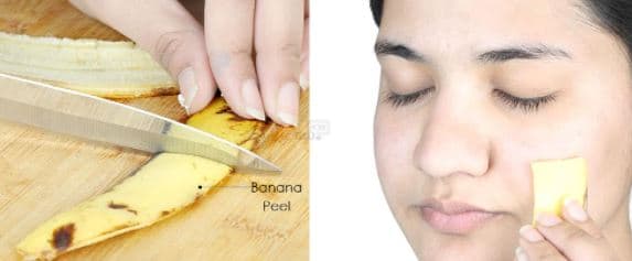Si të përdorni lëkurën e bananes për të trajtuar pigmentimin dhe shenjat e akneve