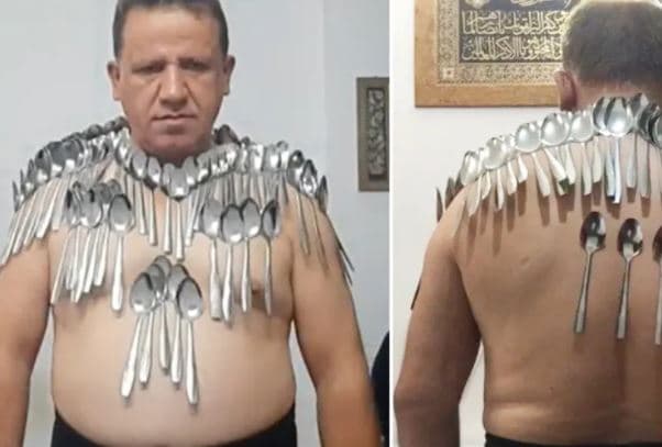 50 vjeçari thyen rekord pasi arrin të ngjisë në trup 85 lugë (VIDEO)