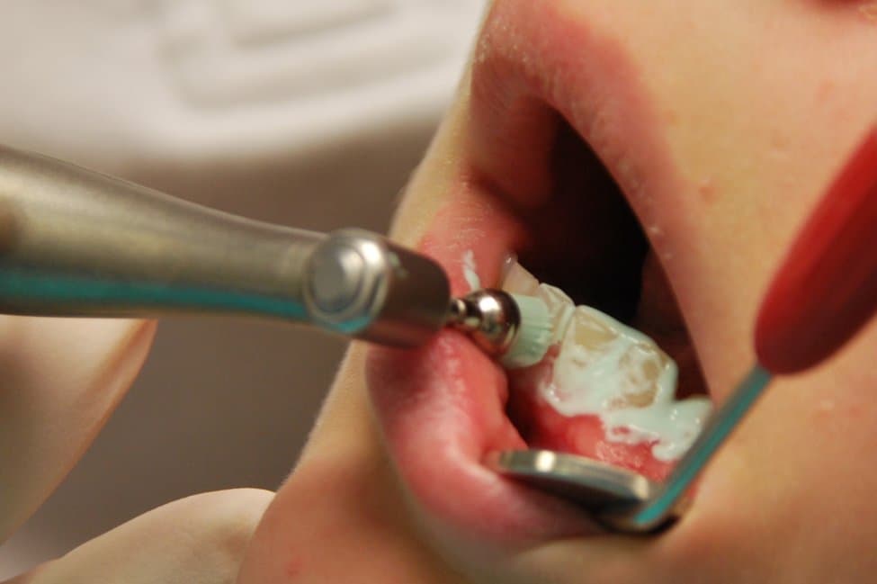 Shëndeti i dobët dentar i vë në rrezik fëmijët me sëmundje të zemrës
