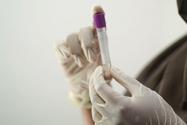 Kolesteroli "i mirë" mund të mbrojë trurin nga sëmundja e Alzheimerit