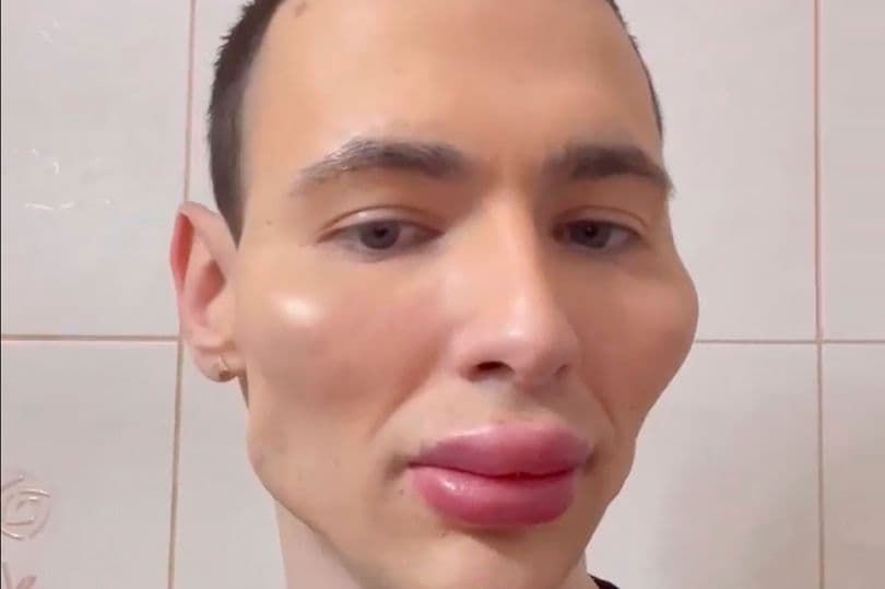 Ish-ushtari rus “Popeye”, tash synon të duket si alien (FOTO)