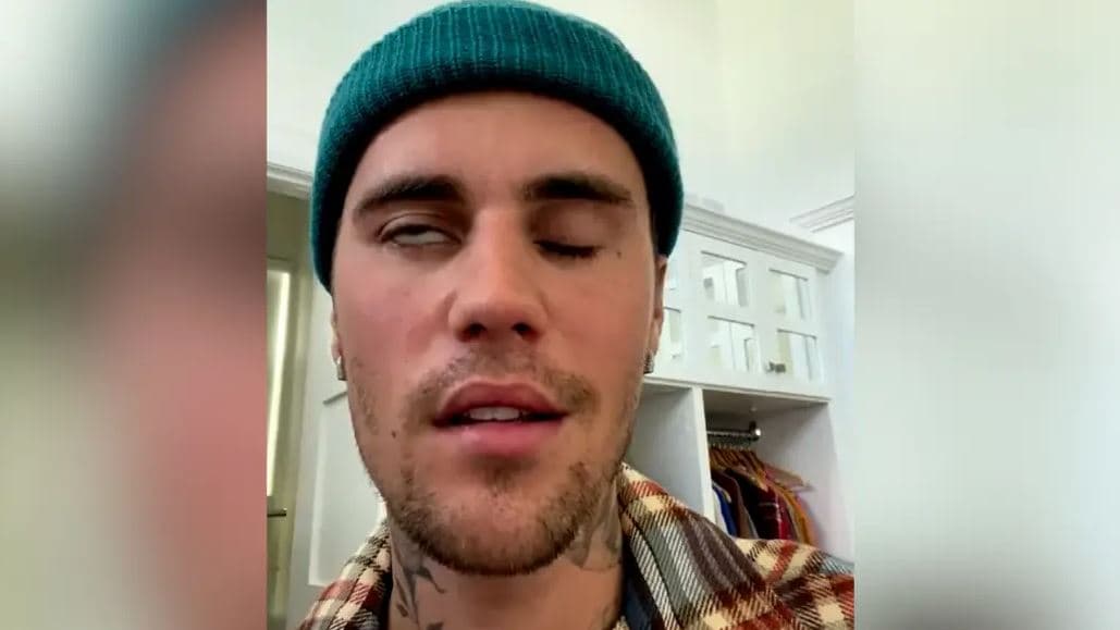 Justin Bieber po tregon shenjat e para të shërimit, thotë kirurgu