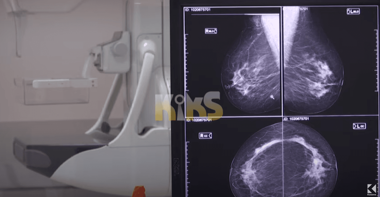 QKUK nuk ka ilaç kundër kancerit të gjirit dhe të lukthit, pacientët privohen nga trajtimi (VIDEO)