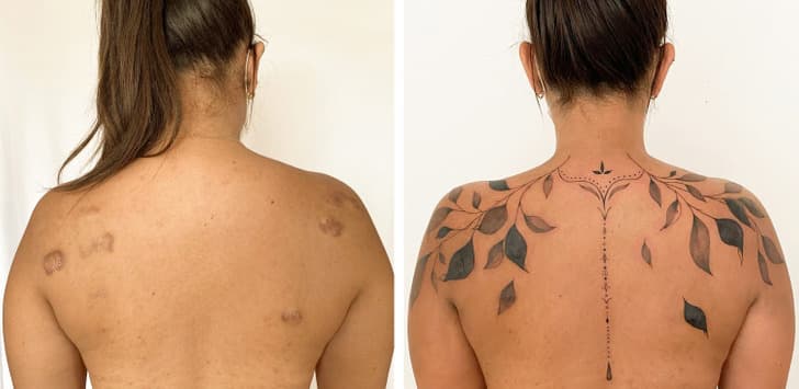Artisti i bën tatuazhe plagët që njerëzit të mund t'i shfaqin tiparet që donin t'i fshihnin (FOTO)