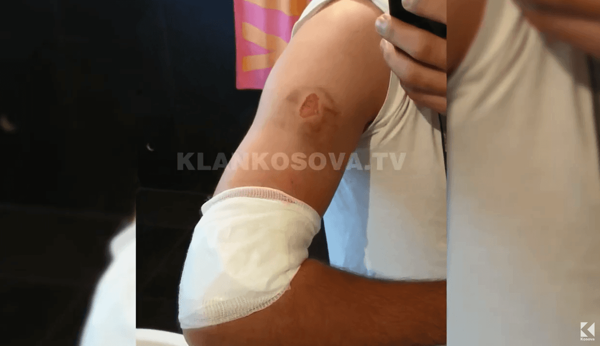 Plagoset një burrë në Deçan, pas gjuajteve në një aheng (VIDEO)