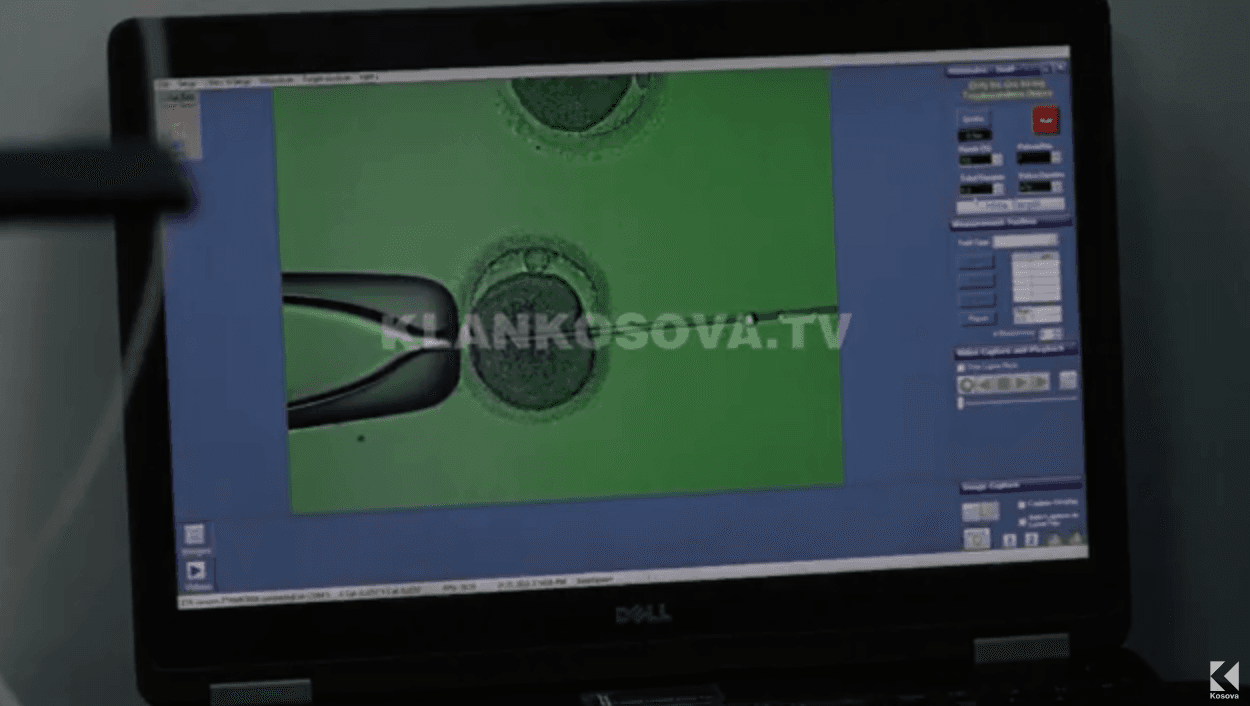 Pak gra kosovare të pamartuara zgjedhin të bëhen nëna me frytnim të asistuar (VIDEO)