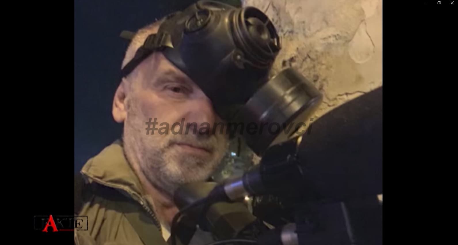“Nanë, kur do t’më rritet dora?”, Kllokoqi tregon historinë e vogëlushes në luftën në Bosnjë (VIDEO)