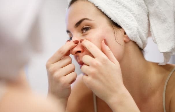 Dermatologët tregojnë se a mund ta përdorni jodin për heqjen e puçrrave
