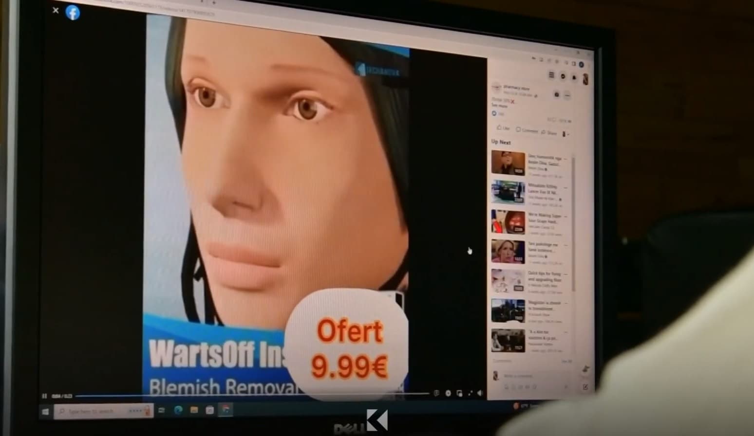 KIKS-i porosit online "ilaçin" për lytha e shenja, i kushton 15 euro (VIDEO)