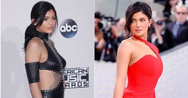 Kylie Jenner e pranon se ka bërë operacion plastik të gjoksit: Bëjini pasi t'i përfundoni fëmijët
