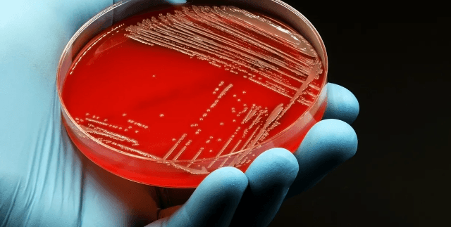 A i fshijnë vërtet antibiotikët bakteret e zorrëve? 