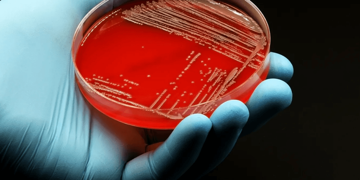 Ekspertët tregojnë efektet anësore nga antibiotikët