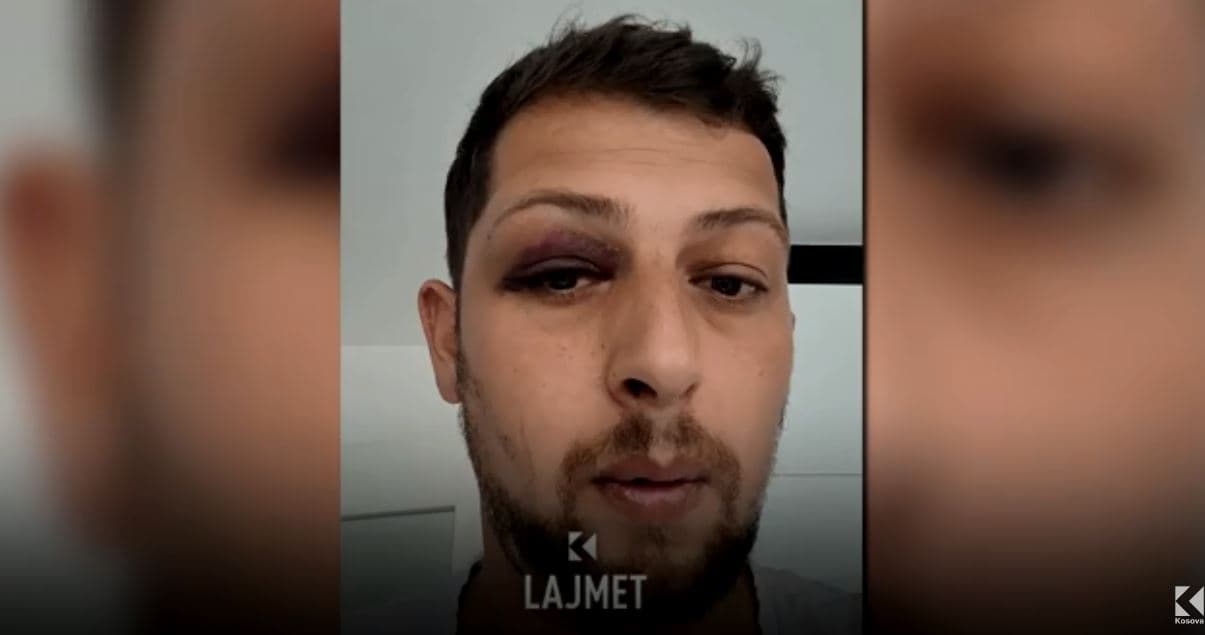 Protestë në Graçanicë kundër rrahjes së një romi nga policia (VIDEO)