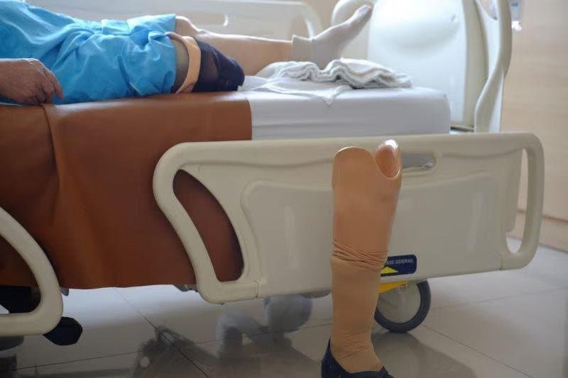 Ilaçi që mund të ngadalësojë sëmundjen e rrallë e cila mund të çojë në amputim