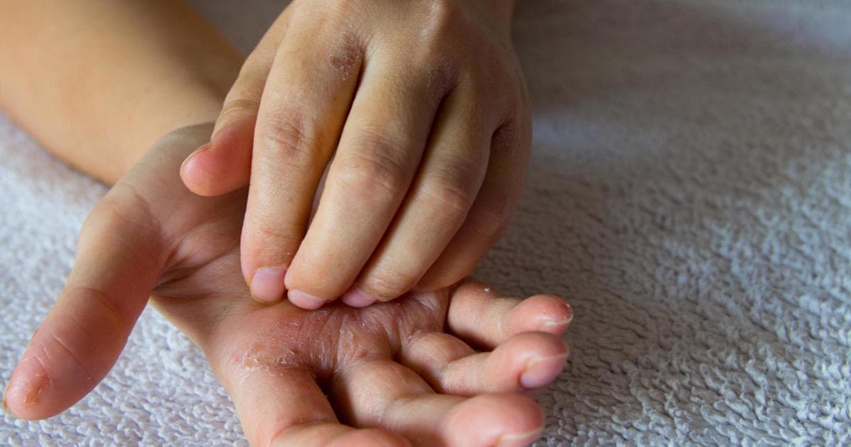 Dora që i kruhej i sjell 30 mijë dollarë në lotari