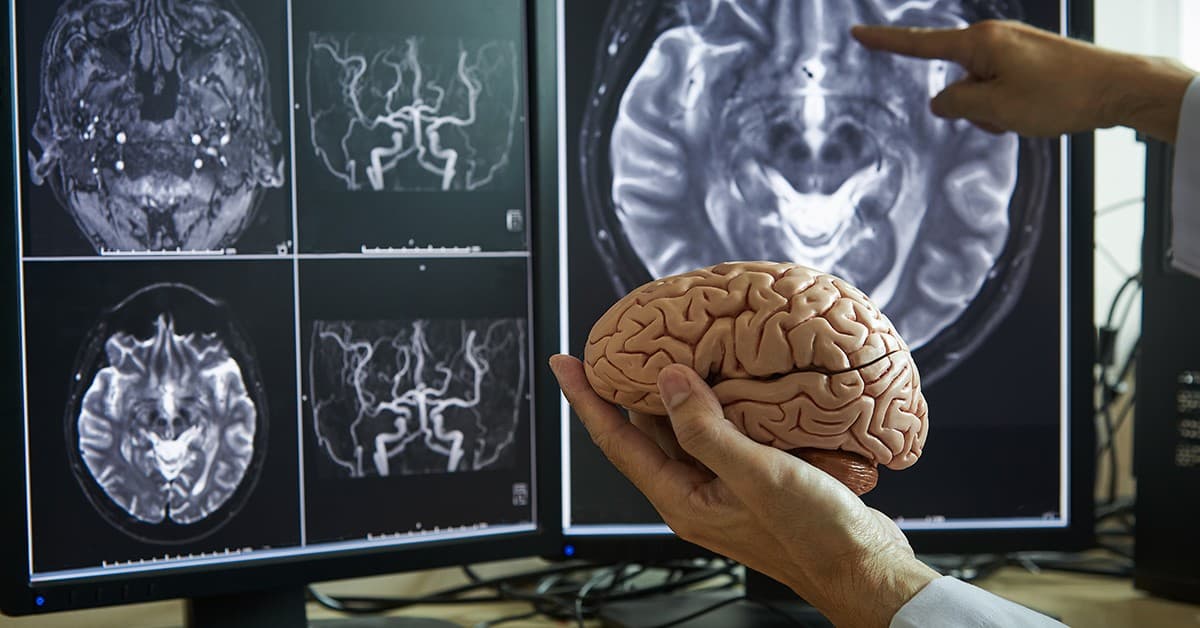 Teknologjia e skanimit të trurit mund të ndihmojë në diagnostikimin e sëmundjeve psikologjike