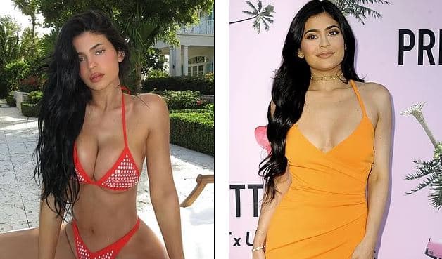 Iu lut një fanse, Kylie Jenner zbulon detajet lidhur me operacionin e gjoksit