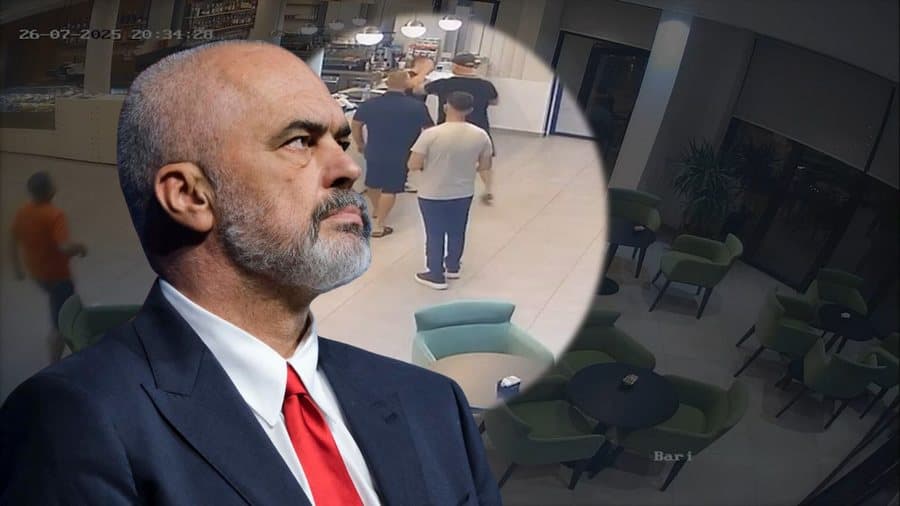 Polici rrahu kamarierin në Vlorë, Rama: T’i dorëzohet drejtësisë sapo të dalë nga spitali