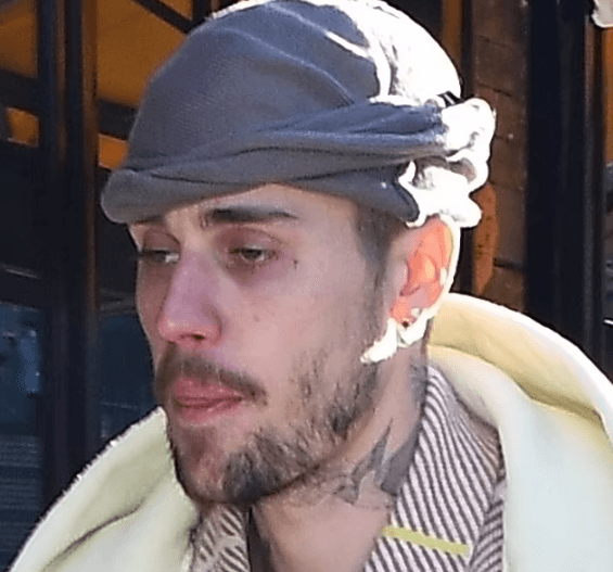 Përdorues i drogave të forta? – Justin Bieber thyen heshtjen